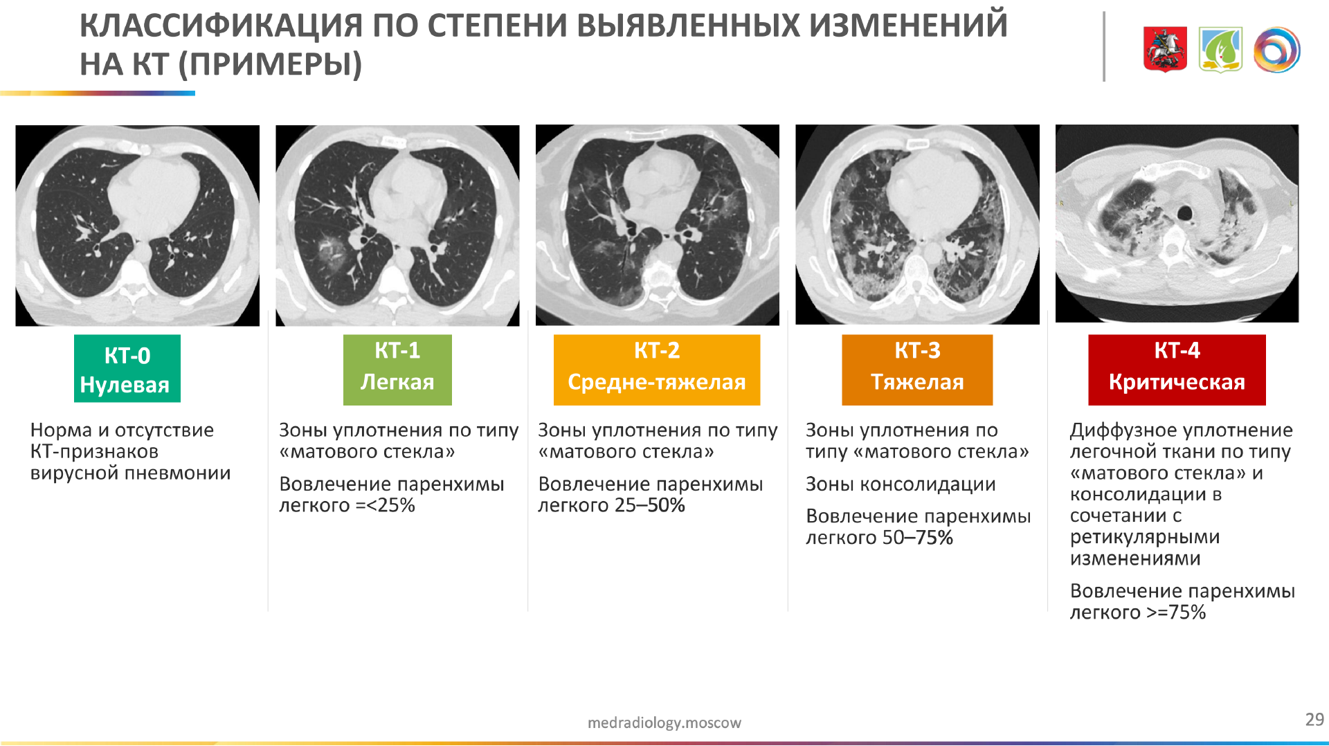 поражение легких при коронавирусе фото рентгена