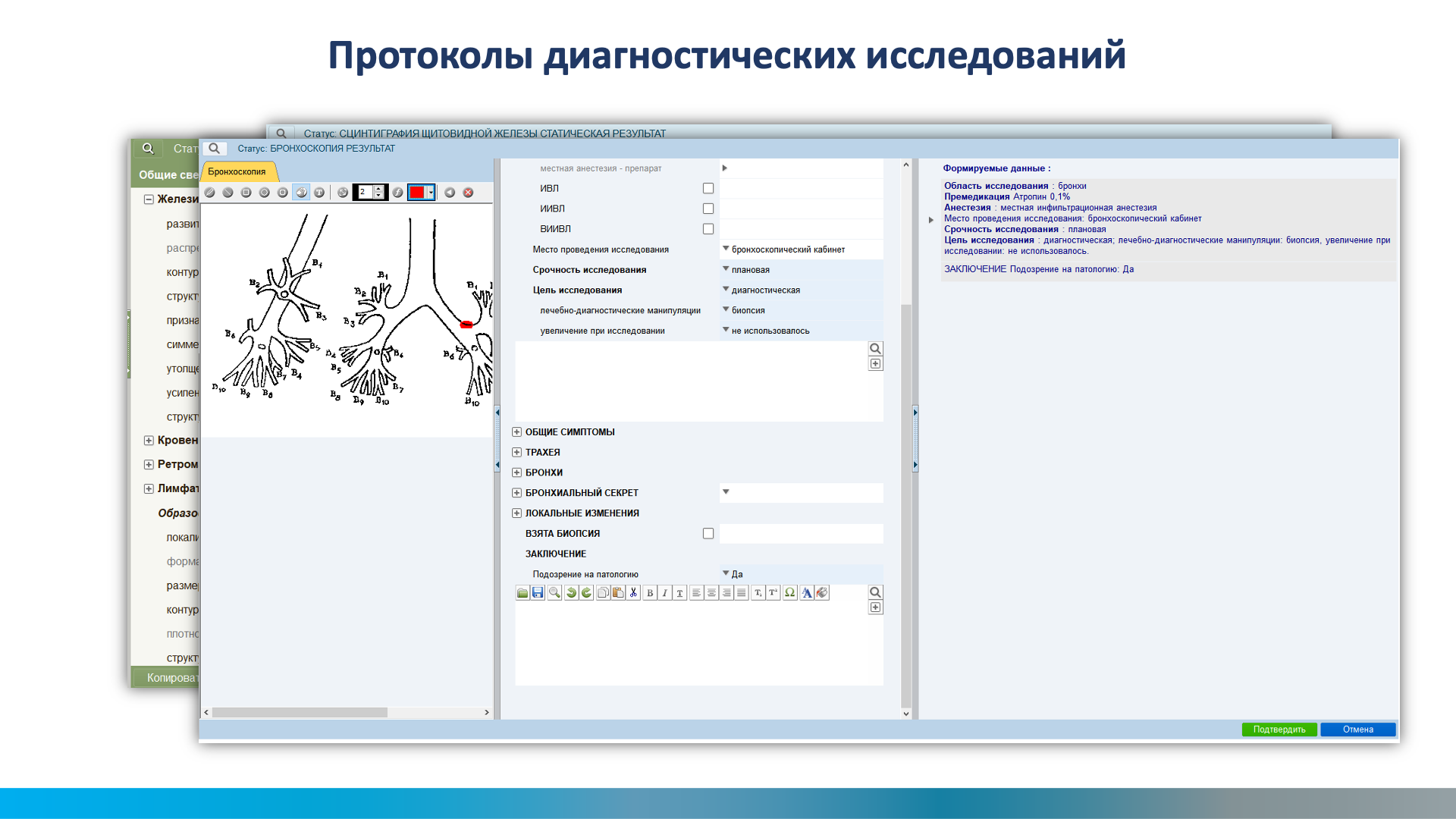электронная медицинская карта мис qms